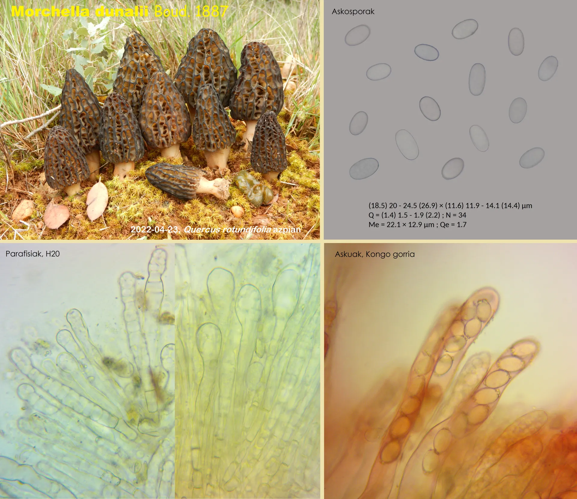 Microscopía de Morchella dunalii